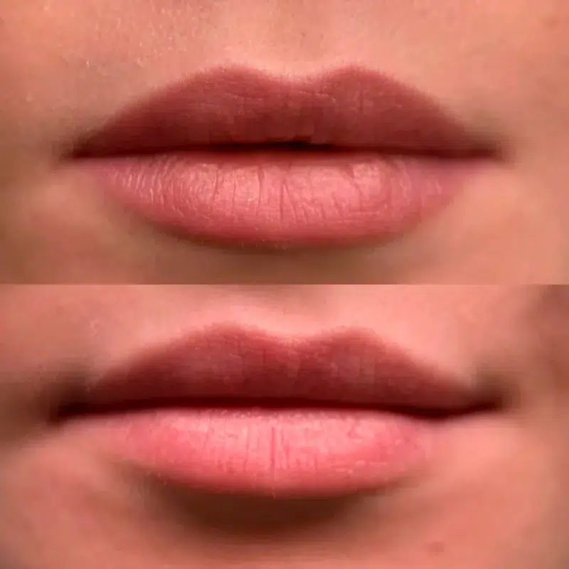 Maquillage permanent levres